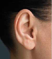Tiny aid inside ear canal